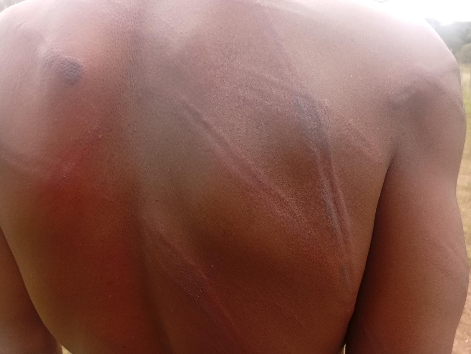 Teachers Condemn Mnangagwa Regime Violence, Vow to Resist “Third Term” Agenda – Eduzim News